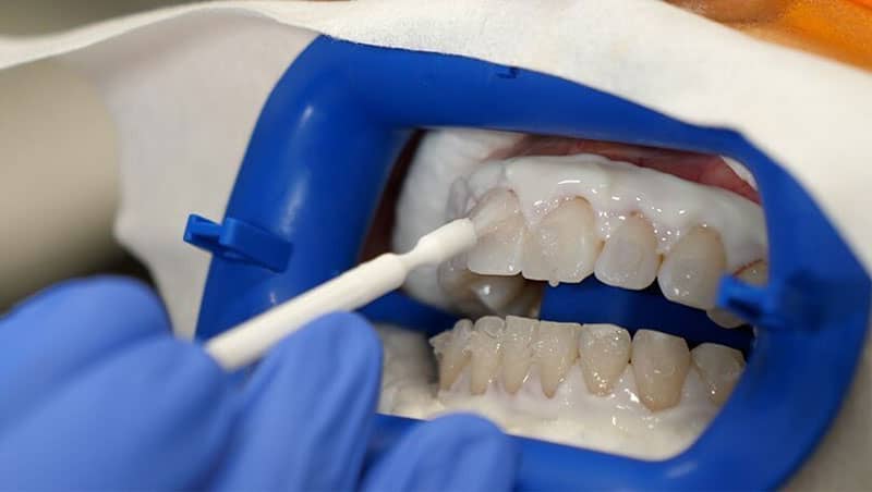 دندانسازی