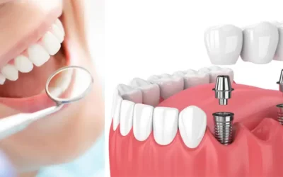 درآمد دندانسازی