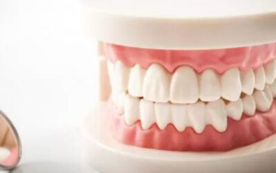 دندان مصنوعی متحرک