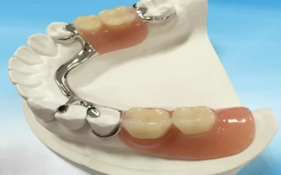 دندان مصنوعی پارسیل