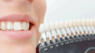 تفاوت لمینیت و لومینیرز