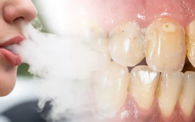 تاثیر ویپ و سیگار الکترونیک بر زردی دندان و بیماری لثه