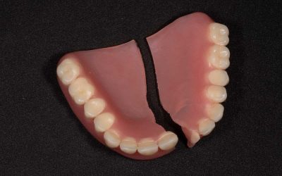 ترمیم شکستگی دندان مصنوعی